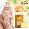 Reshma Beauty Turmeric Soap | Infused with Turmeric Extract, Olive