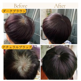 Luce brillare Partial Wig, Whorl, Crown of Head, Human Hair Piece, Top Piece, Point Piece, Part Wig Men's, Women's, Whirl, Parietal, Human Hair, Men's, Women's, Wig Short, Domestic Manufacturer, Hair Plus to Whorl + (Natural Brown)