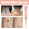 EELHOE Tattoo Removal Cleaner - Plant-Based Essence Formula for Fading