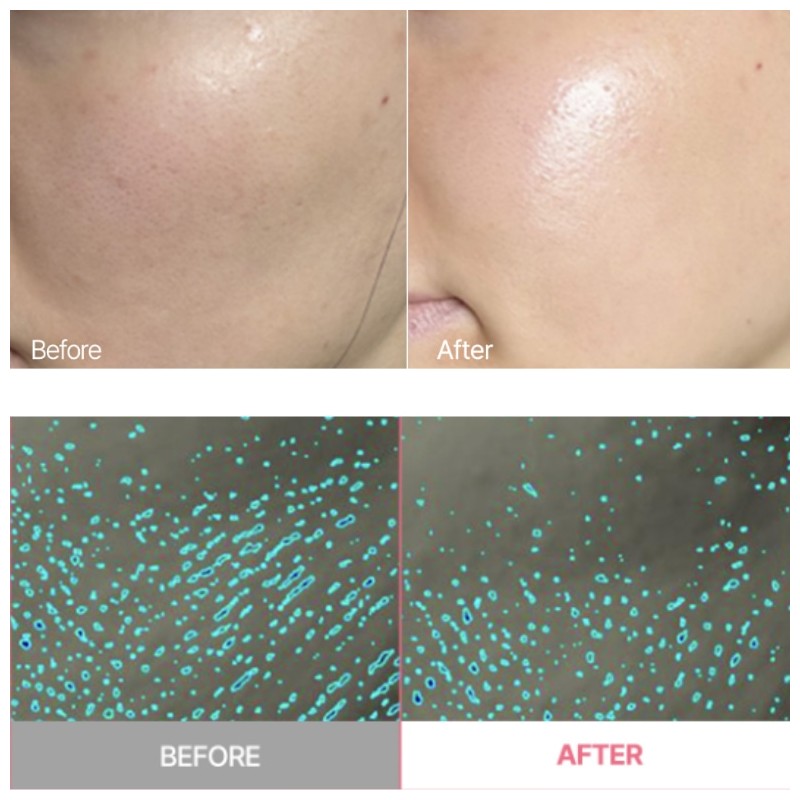 APRILSKIN TXA Niacinamide Toning Shot 99 Serum 30ml