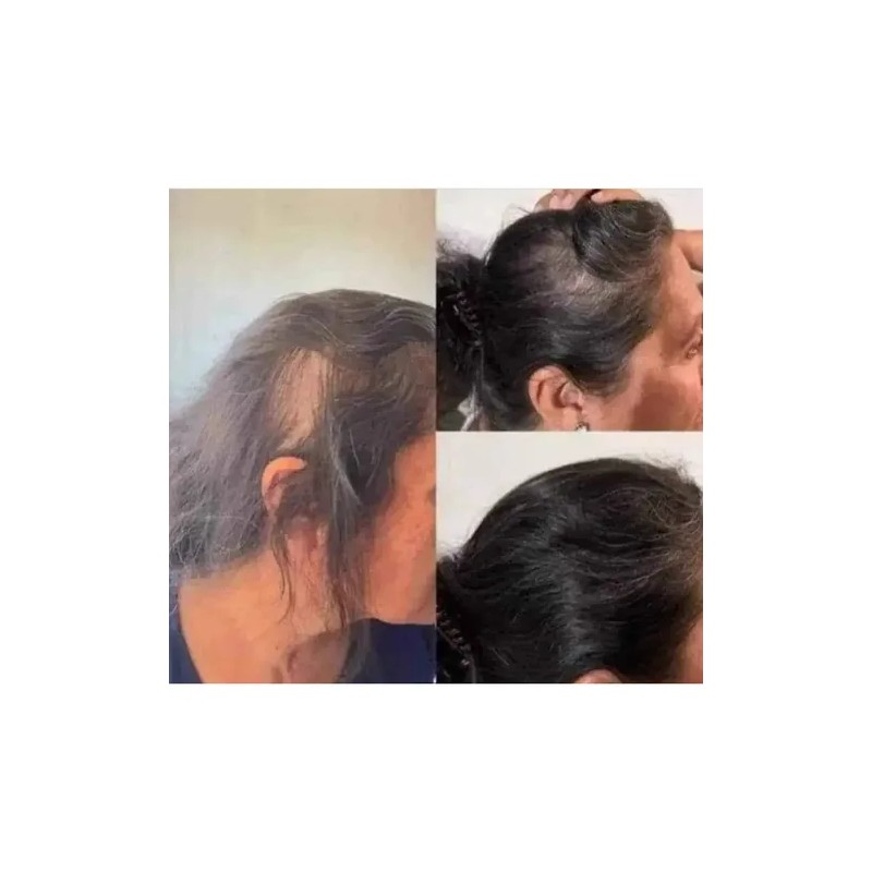 2pzs Shampoo Reviving Farmasipara Crecimiento De Cabello