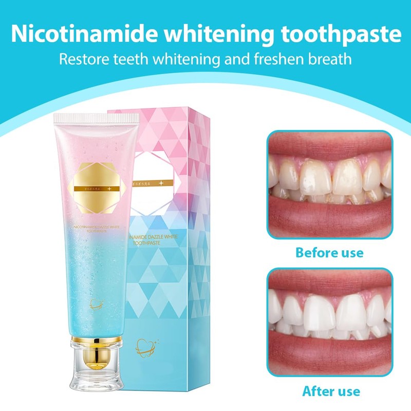 GXGM Niacinamide Whitening Toothpaste, Fresh Breath, Radiant Whitening Toothpaste, Toothpaste