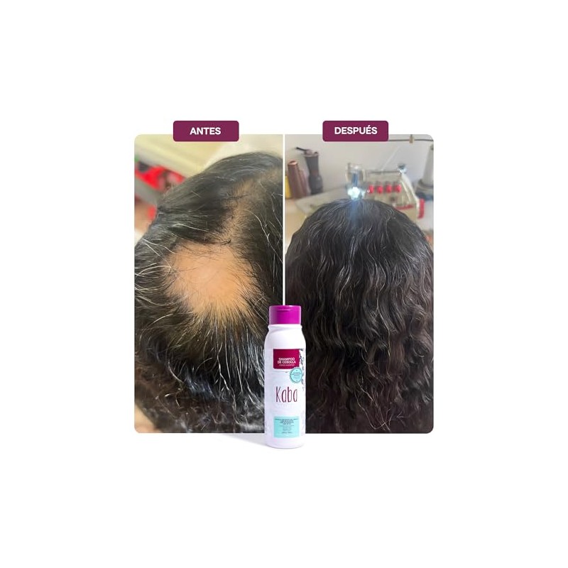 Kaba Shampoo Anti Caida Cabello Cebolla Roja Estimula Crecimiento Clinicamente