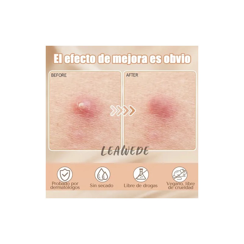 240pzs Mascarillas Estrella Para El Acne Espinillas Granos