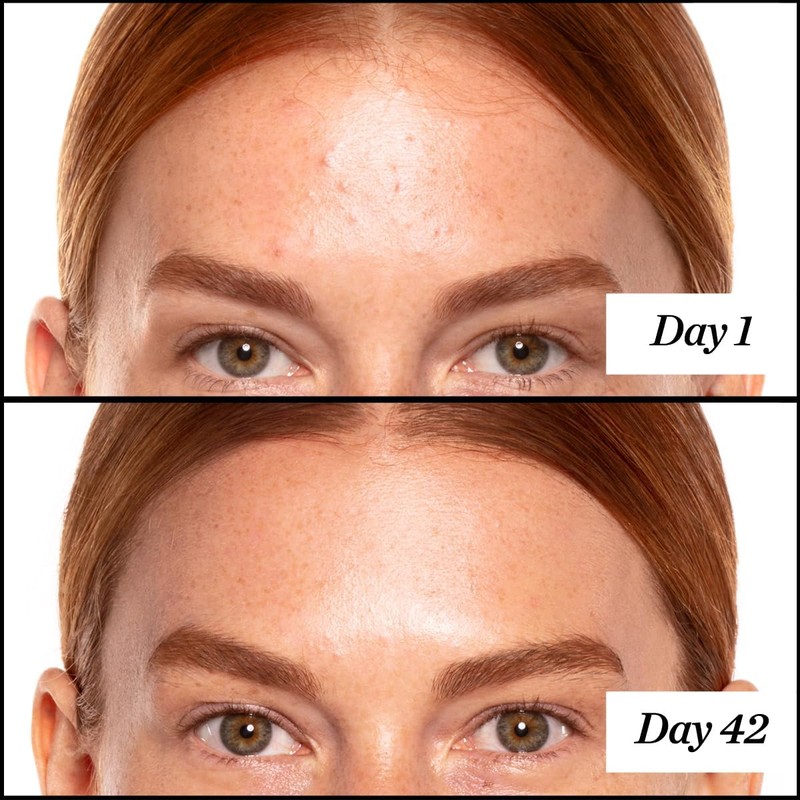 Sunday Riley A+ High-Dose Retinoid Serum 1oz