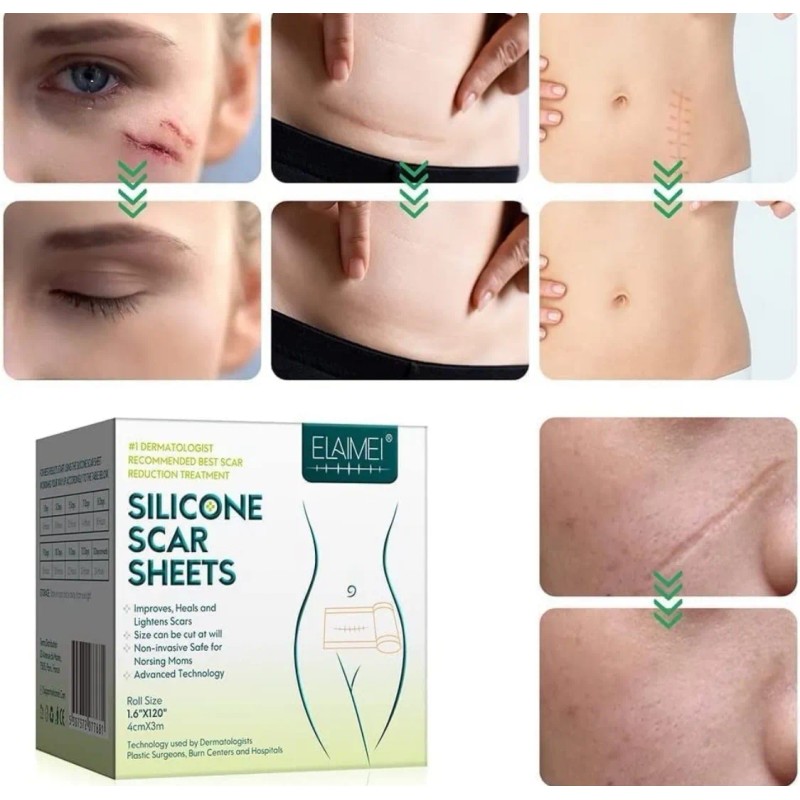 Kit Cicatrices Scar Gel/parche Abdominoplastia, Cirugía 3m Neutra
