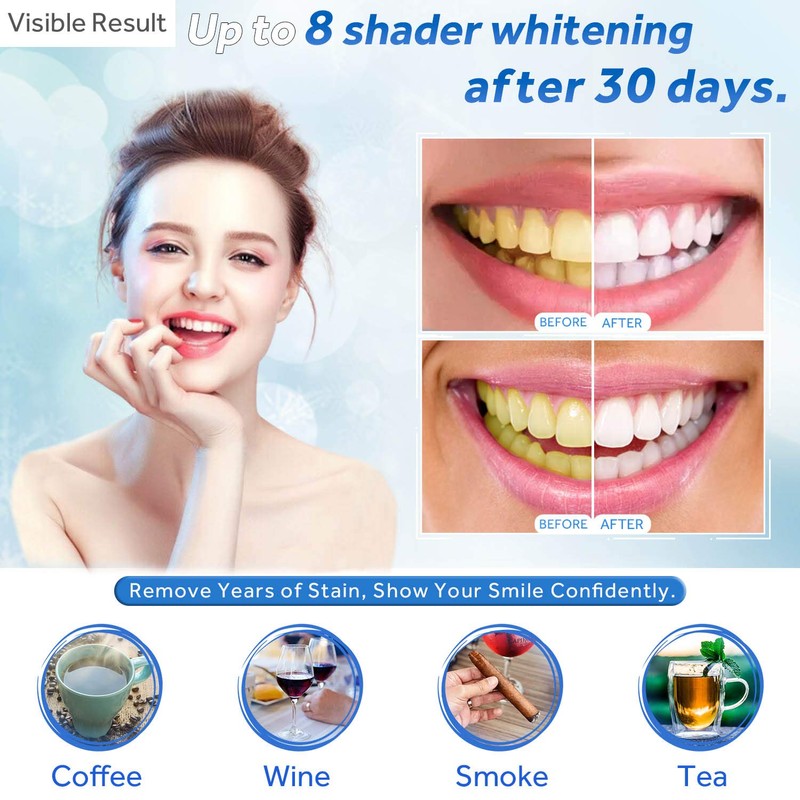 EZGO 10 Pack Teeth Whitening Gel Refills 22% Bleaching Gel,