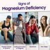 Fast&Up Magnesium - 300mg Magnesium & 10mg Zinc - 20