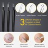 Pimple Popper Tool Kit - Boxoyx 10 Pcs Blackhead Remover