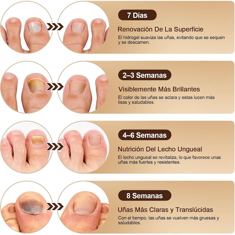 Parches Cuidado para Uñas de Pies, Mejorar el Aspecto de