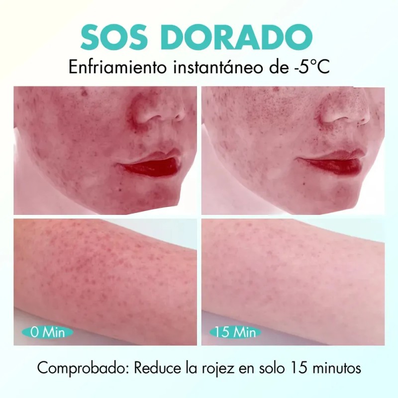 Timmi Beauty After Sun Gel Aloe Vera Calmante Hidratante 50g