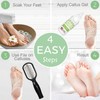 Dr. Entre's Callus Remover Gel & Foot File: Extra Strength
