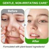 Blackhead Remover Mask 2% BHA Peel Off Kit for Nose