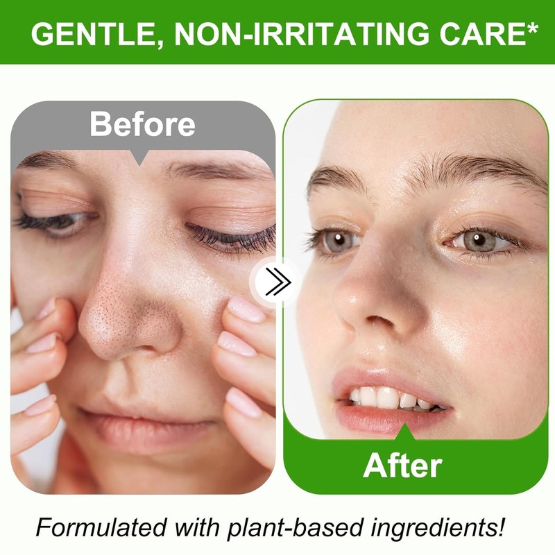 Blackhead Remover Mask 2% BHA Peel Off Kit for Nose