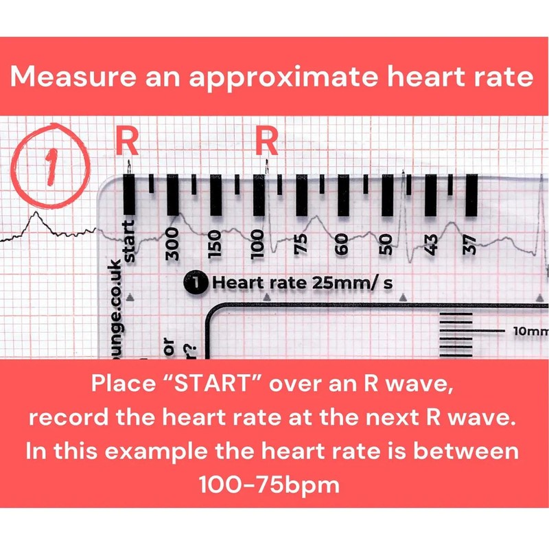 ECG 7 Step Ruler, ECG/EKG 7 Step Ruler Card for