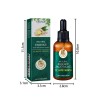 Aceite Esencial De Jengibre Para El Cuidado Del Cabello: Par