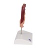3B Scientific Human Anatomy - Gallstone Model + Free Anatomy