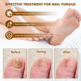 7 Day Ginger Nail Treatment 60ml, Nail Treatment, Nail Growth Serum, Ginger Nail Serum, Nail Nutrient Oil Strengthener Oil.