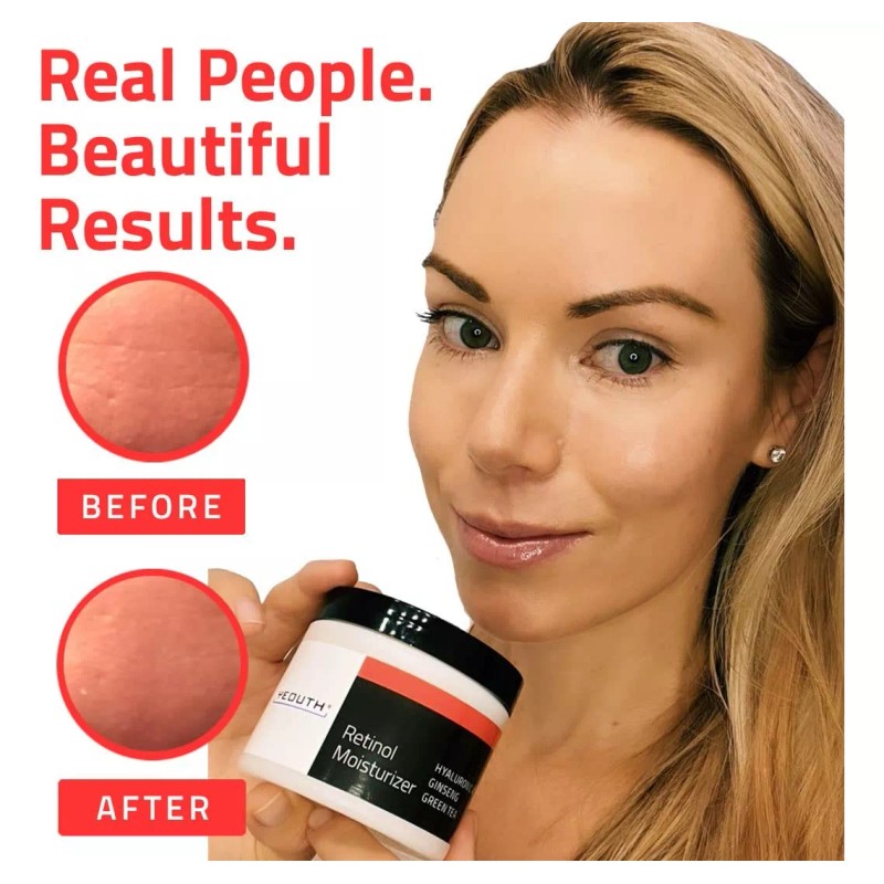 Yeouth Hidratante Facial Con Retinol Con Ácido Hialurónico