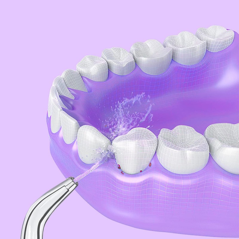 Replacement Tips for Waterpik Classic Jet Tip 4 Pack