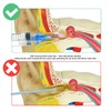 ETTSNU 20mL Ear Syringes for Removing Ear Wax, Cleaning Water