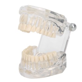 Dental Model, Transparent Acrylic Dental Teeth Model, Simulation Mouth Model, Teeth Typodonts Mode Gingiva Visible Anatomic Demonstration for Teaching, Studying