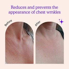 BLUMBODY Chest Wrinkle Pads – Anti-Wrinkle Silicone Patches Skin Firming, Smoothing – Reusable Overnight Chest Pad – Anti-Aging Crepe Erase Pads – Neck, Décolleté (1.5-Month Supply)