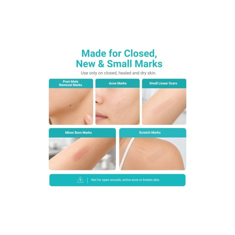 Rollo de cinta adhesiva de silicona fina para cicatrices faciales
