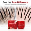 Scalp Scrub,150g Scalp Scrub Psoriasis Red Jar(2pcs)