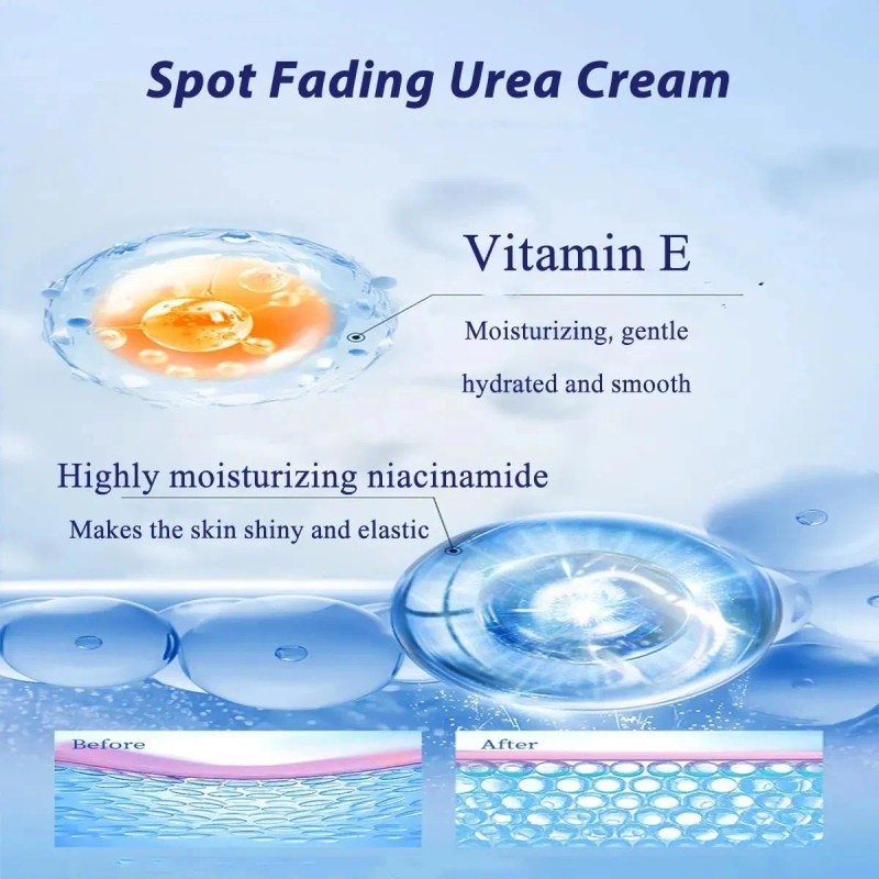 Crema De Urea Para Aclarar Manchas Y Reducir Arrugas.