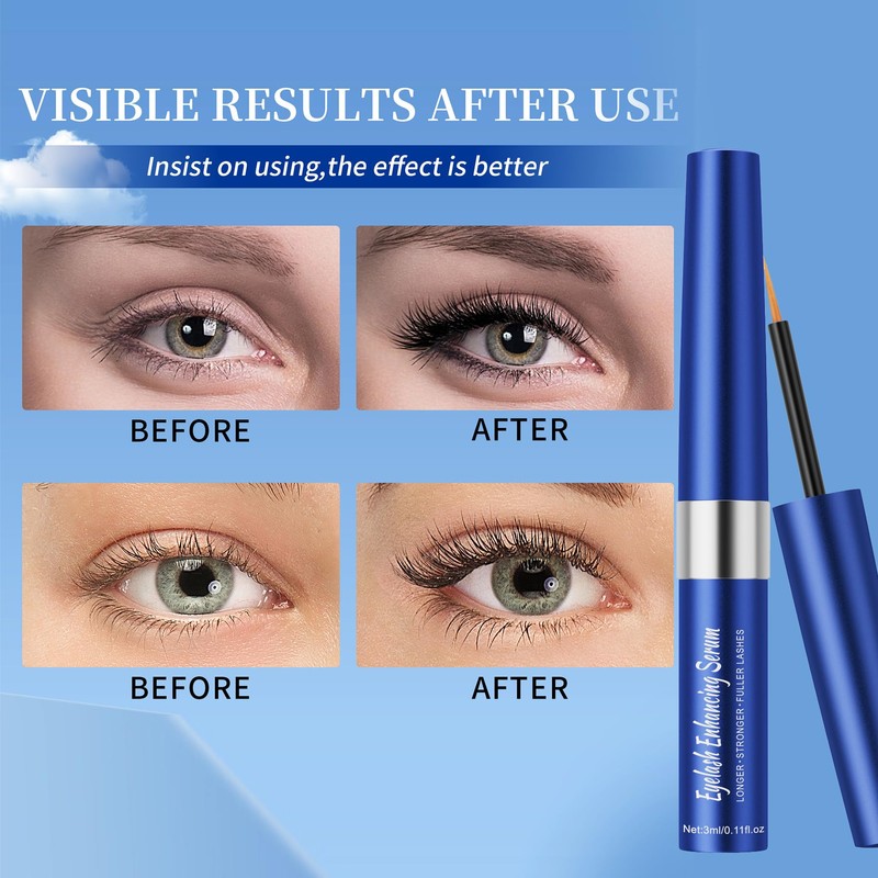 Eyelash Growth Serum – Lash Enhancing Treatment for Longer, Fuller,