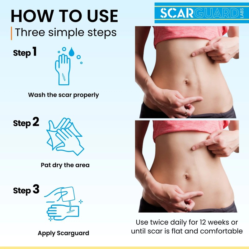 Scarguard - Invisible Brush-On Silicone Sheet with Vitamin E -