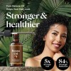 Yl Aceite De Batana 30ml For Cabello, Crecimiento Y