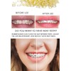 RZJZGZ 500 pcs Orthodontic Elastic Bands Dental Orthodontic Elastics Latex