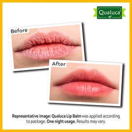 Qualuca Lip Balm Repair with Calendula & Vitamin A, Lip Balm for Dry Lips - 20 g