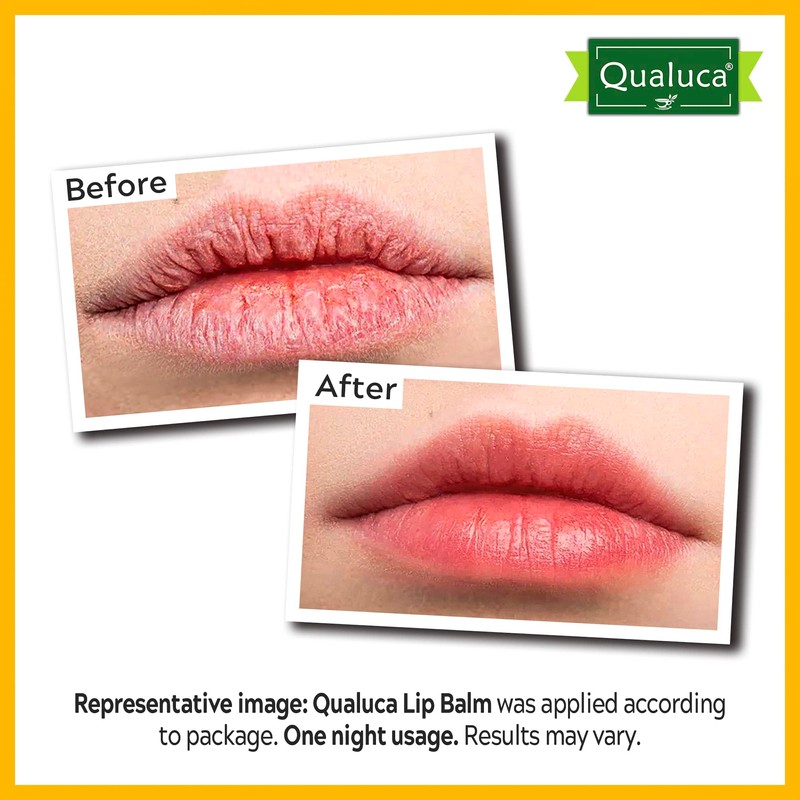 Qualuca Lip Balm Repair with Calendula & Vitamin A, Lip