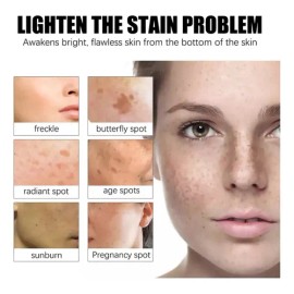 Crema Betarretin H Manchas 30 G Crema Betarretin Manchas