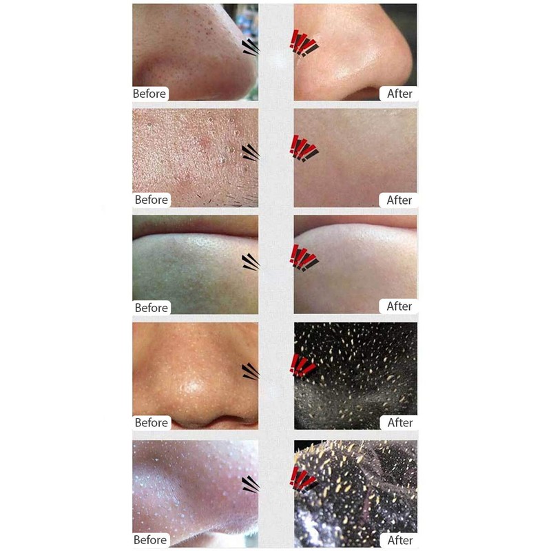Blackhead Remover Black Mask (100 g) Deep Cleansing Peel-off Mask