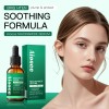 Sérum De Niacinamida Rejuvenate Illuminate Free Shine