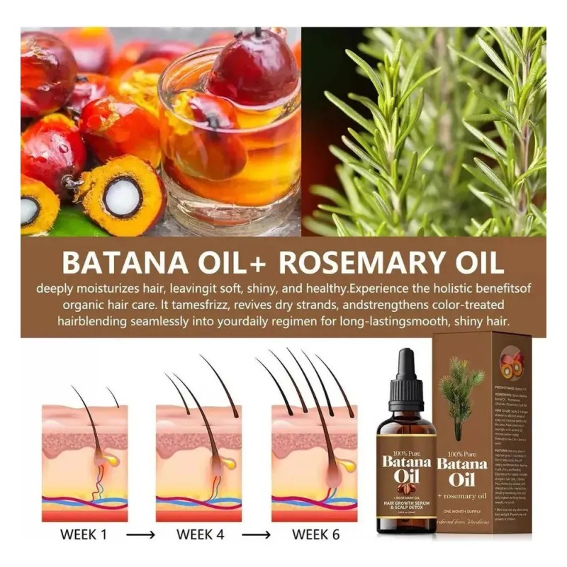 . 1 Unidades Aceite Batana Orgánico Y Romero .