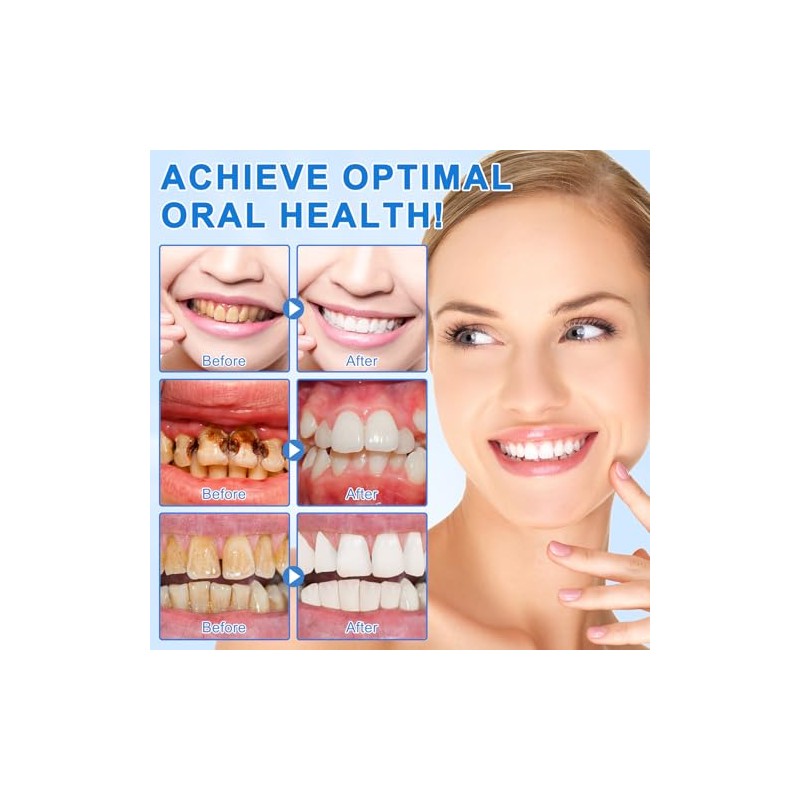 Hydroxyapatite Toothpaste 2PC for Enamel Protection, Contains 9.9% Nano-Hydroxyapatite, Restores