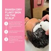 FUL Detox Scalp Treatment, 150ml, with Turmeric and Aloe Vera,