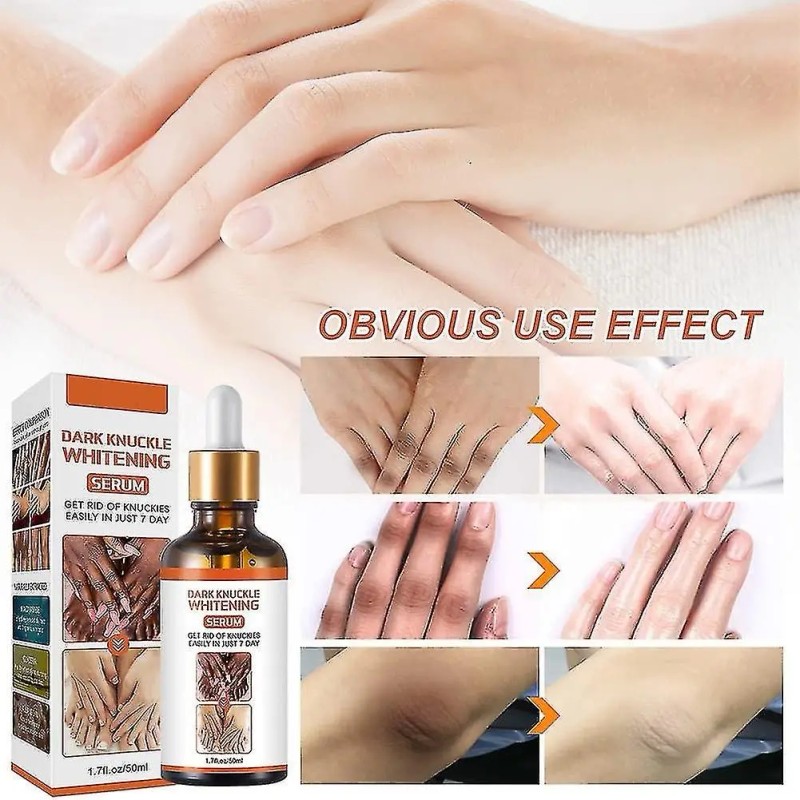 Serum Despigmentante Aclarante Axilas Pezon Codos Intimo 50g