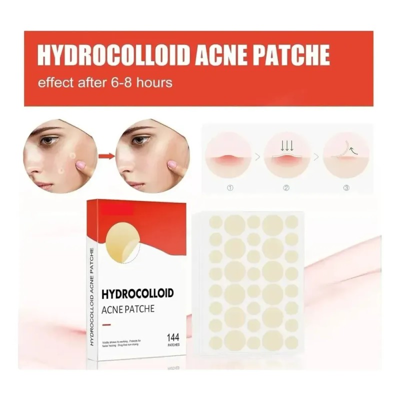 ! Set De 144 Parches Faciales Hidrocoloides Espinillas Hx