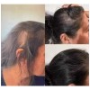 2pzs Shampoo Reviving Farmasipara Crecimiento De Cabello