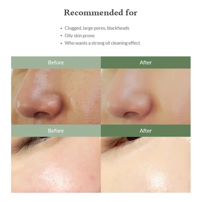 Limpiador Facial Dr. Althea Quick Step Control Sebo Extracto Plantas