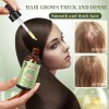 Sérum Capilar Natural De Romero, Aceite Nutritivo Y Reparado