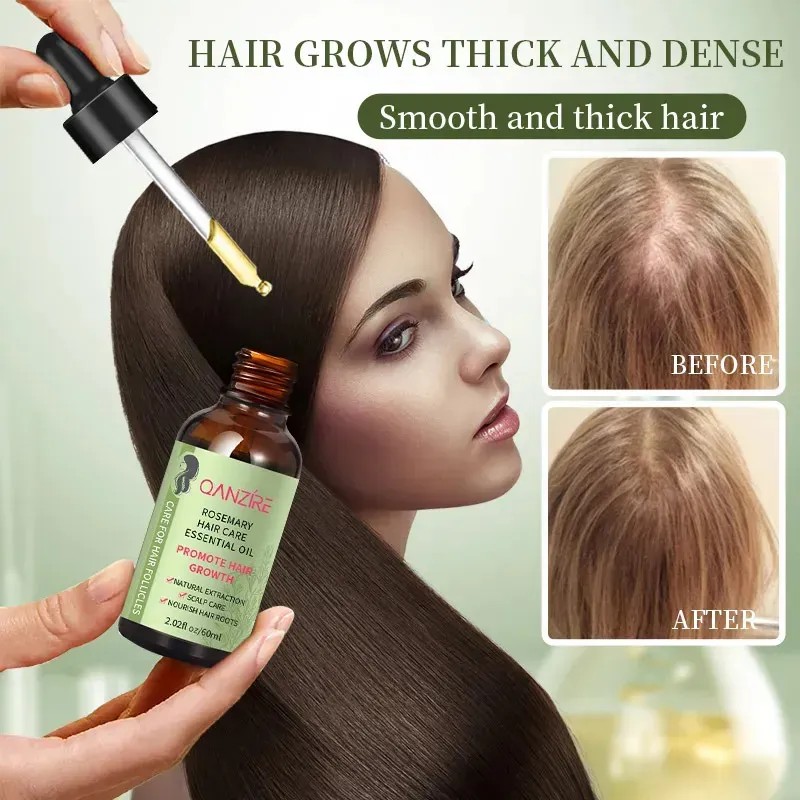 Sérum Capilar Natural De Romero, Aceite Nutritivo Y Reparado