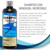 Gaero Global Solution Shampoo Anticaída Incredibl Shop Previene Pérdida Cabello