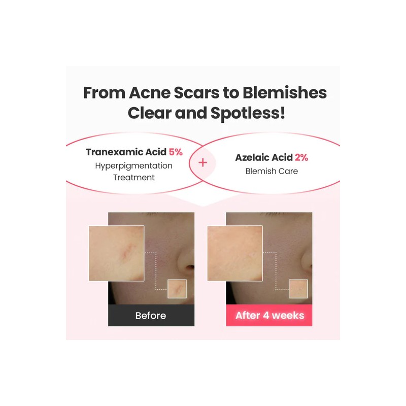 Dr.G [Dr.G]Red Blemish Tranexamic Acid 21.5 Repair Serum 30ml